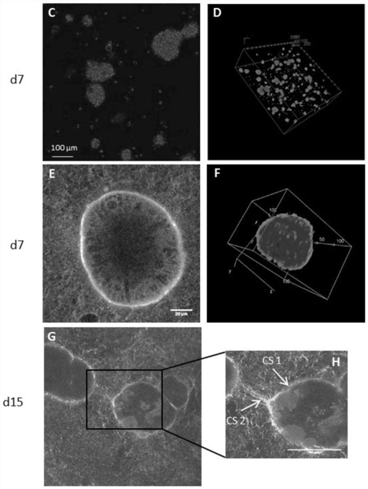 Method of culturing proliferative hepatocytes