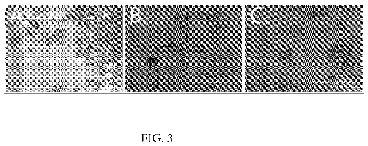 Encapsulated antimicrobials and related methods of treatment