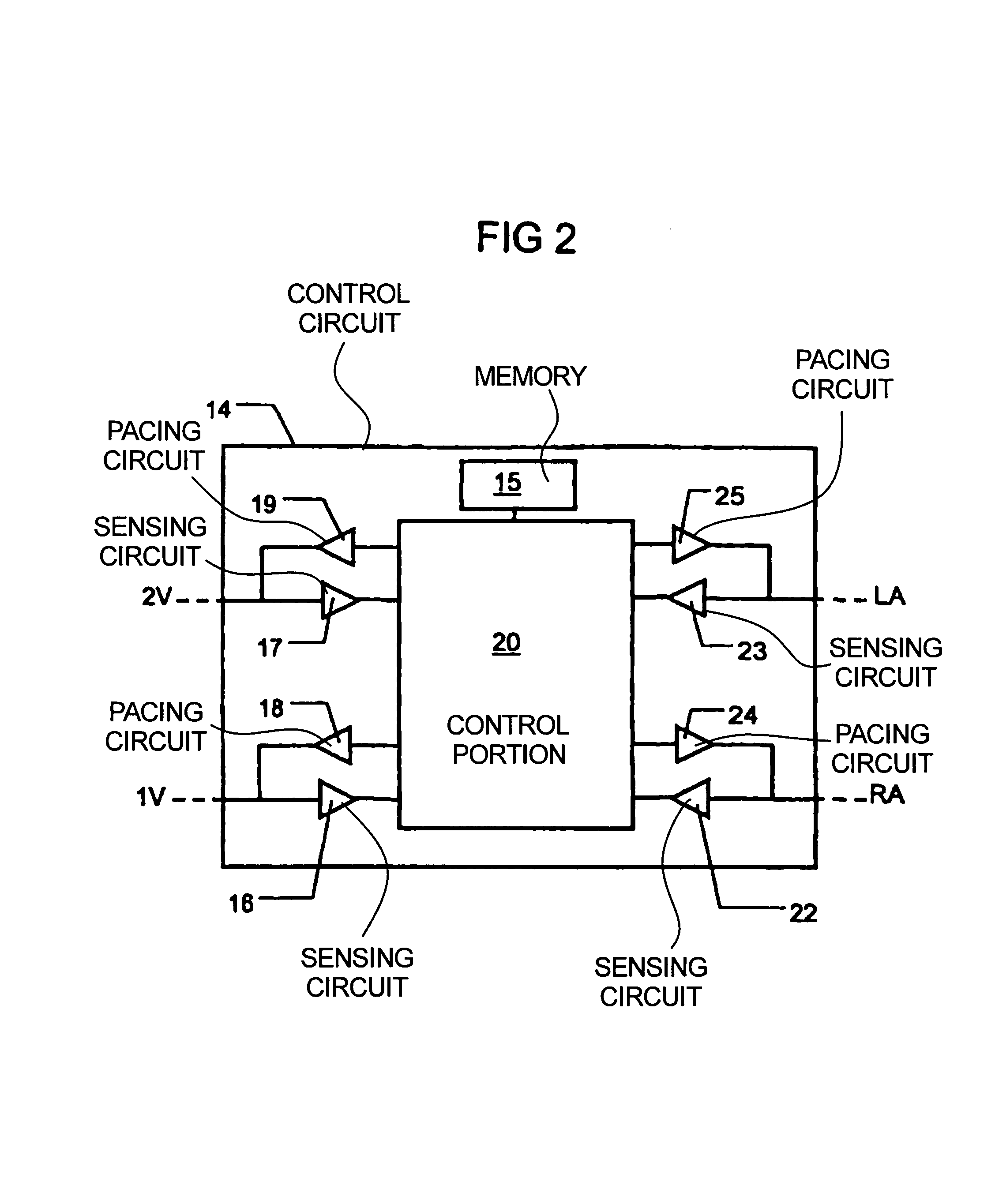 Implantable heart stimulating device, system and method