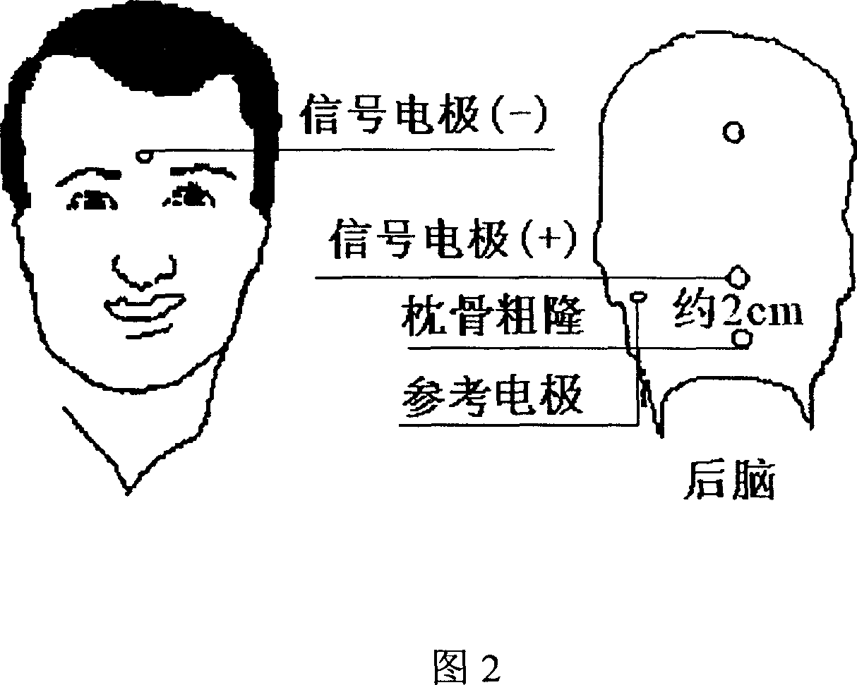 Self-reference, self-correlation and self-adaptive interference balancing method of evoked potential single extracted