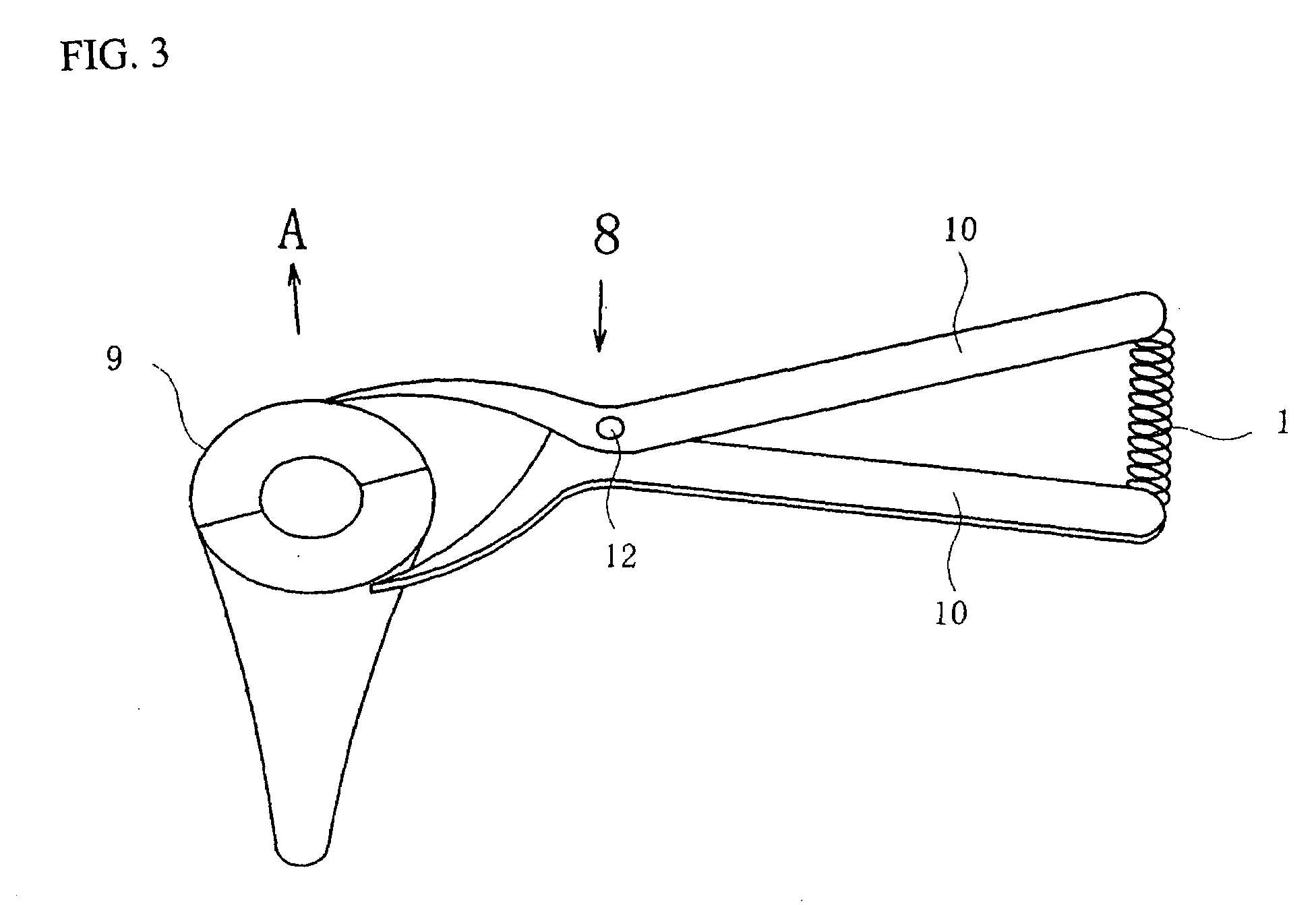 Gastro-tube using a shape-retentive alloy and method of use thereof