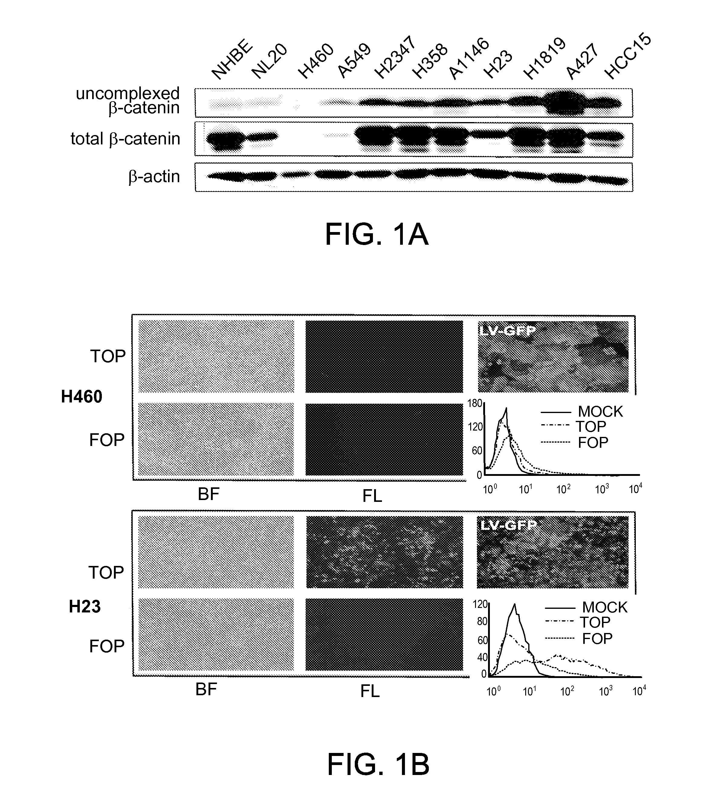 Methods of determining whether the wnt signaling pathway is upregulated in a tumor