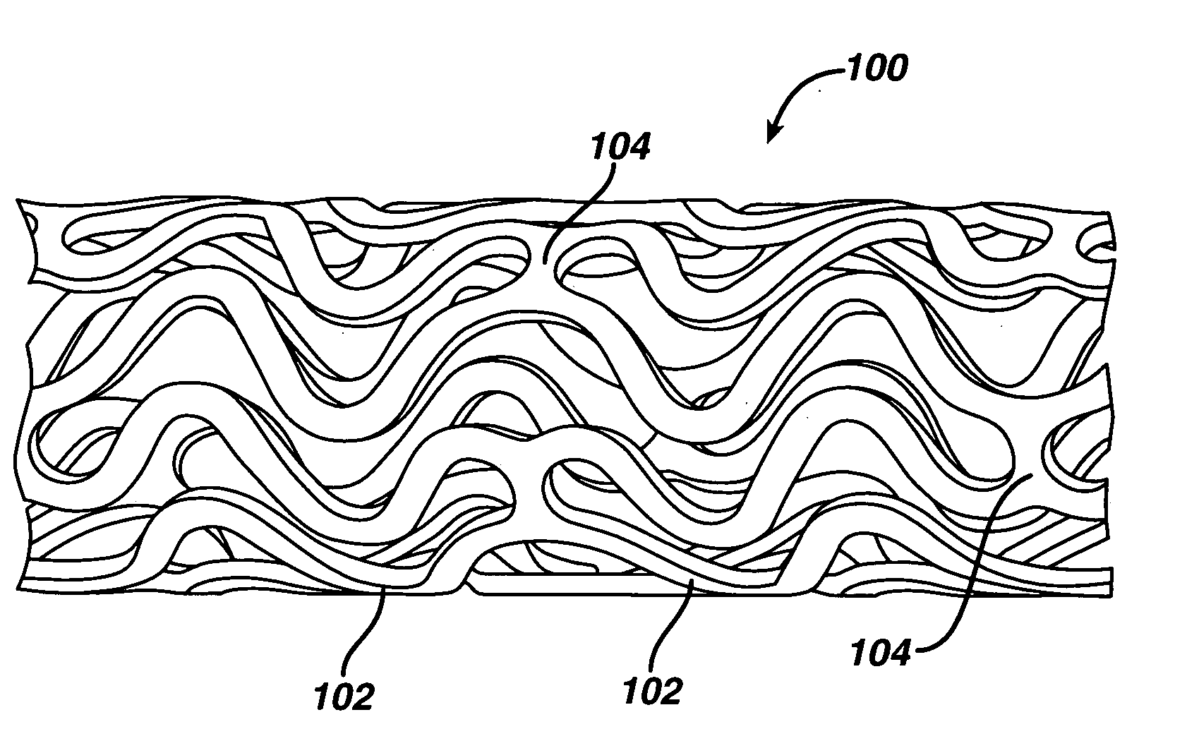 Intraluminal device and therapeutic agent combination for treating aneurysmal disease