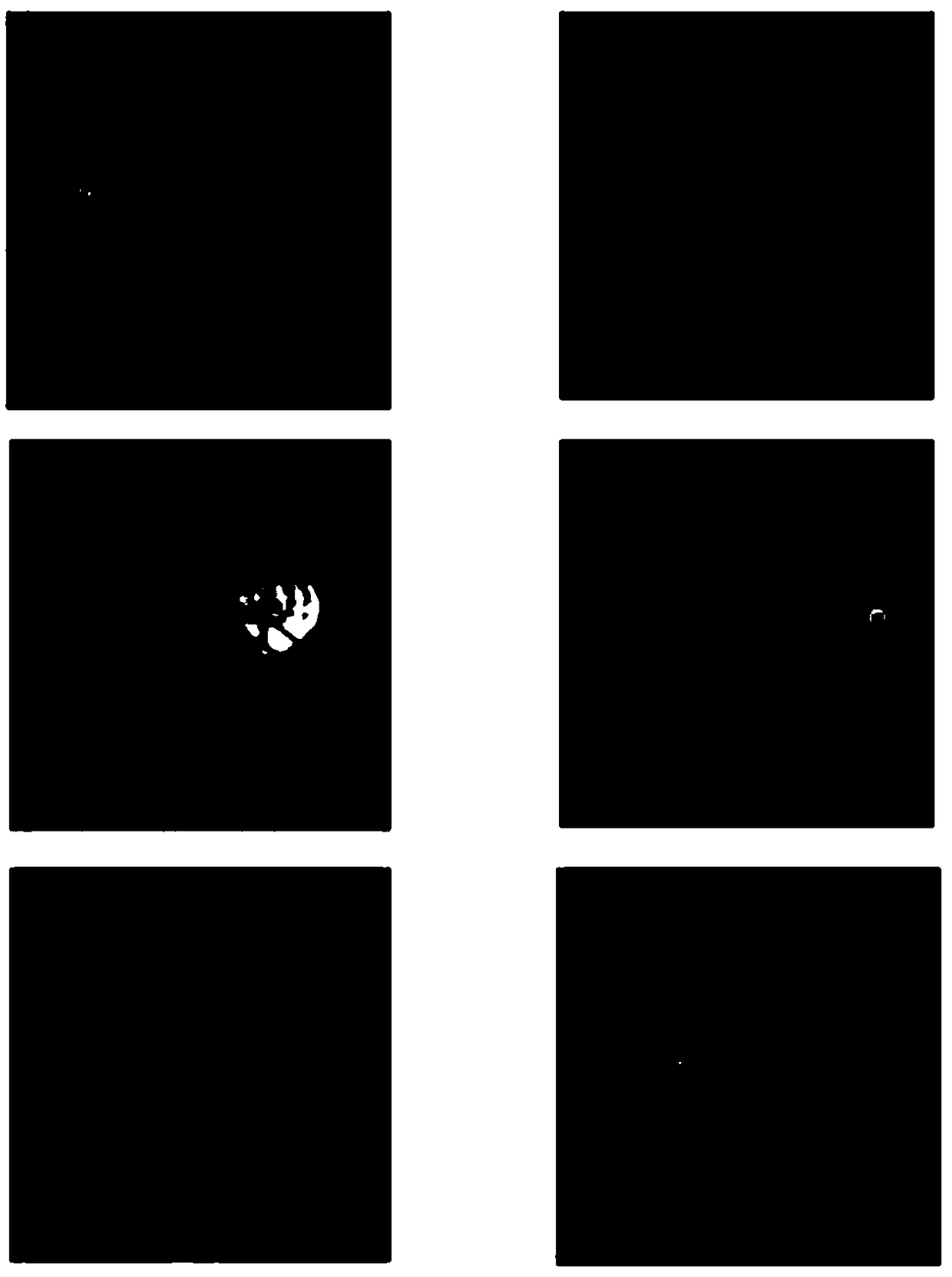 RPN (Region Proposal Network)-based optic disk positioning method