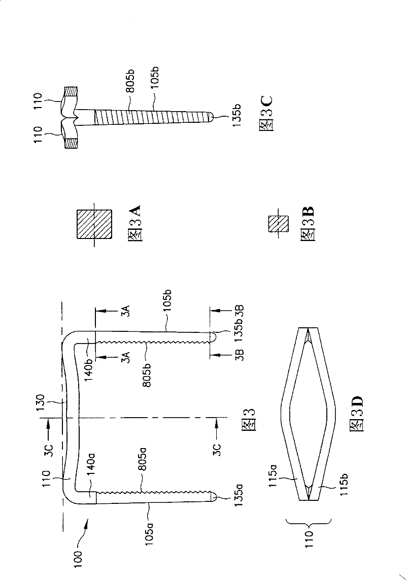 Bone synthesis clip and surgical operation system including bone synthesis clip