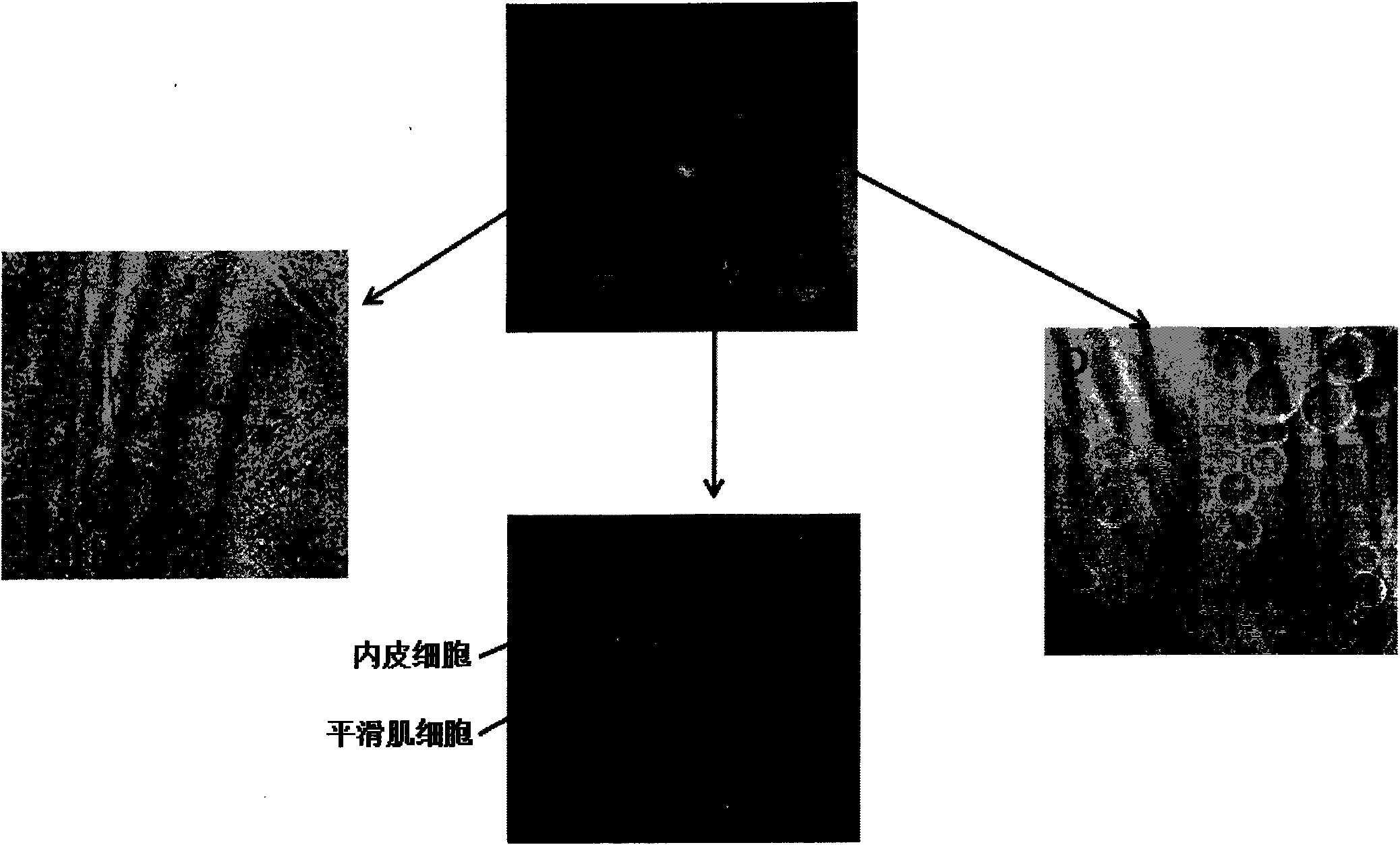 Injection type vascularized adipose tissue and construction method thereof