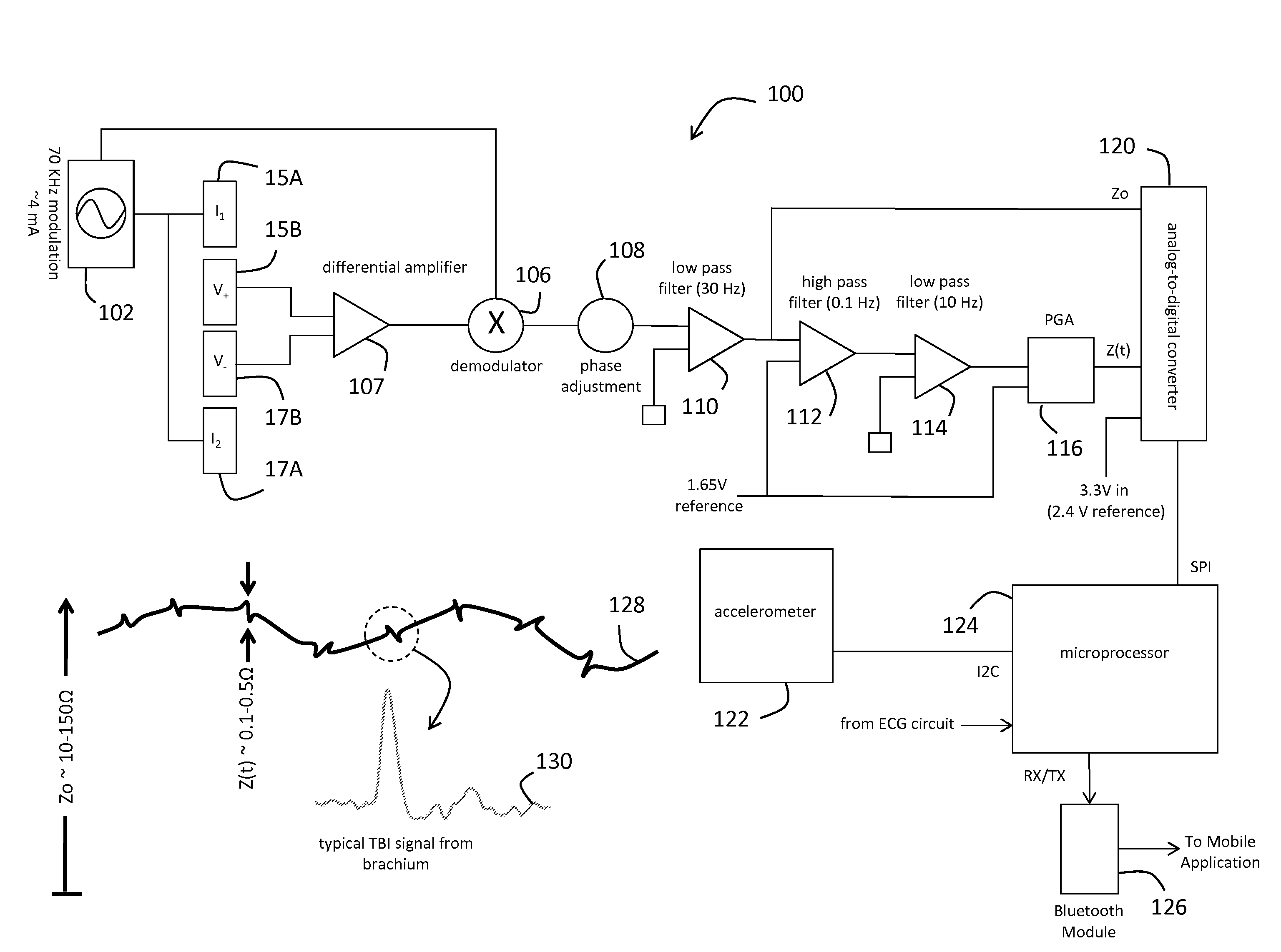 System for electrophysiology that includes software module and body-worn monitor