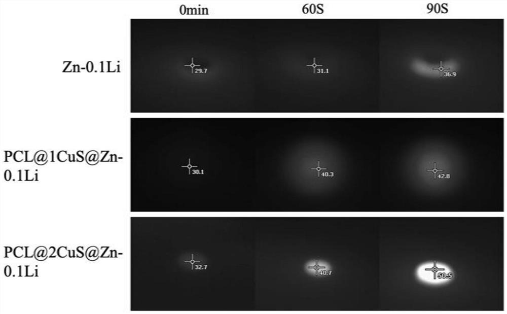 A kind of degradable zinc-lithium alloy surface coating and preparation method and use thereof