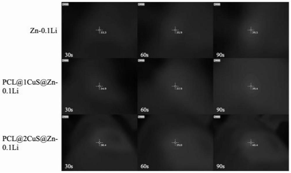 A kind of degradable zinc-lithium alloy surface coating and preparation method and use thereof