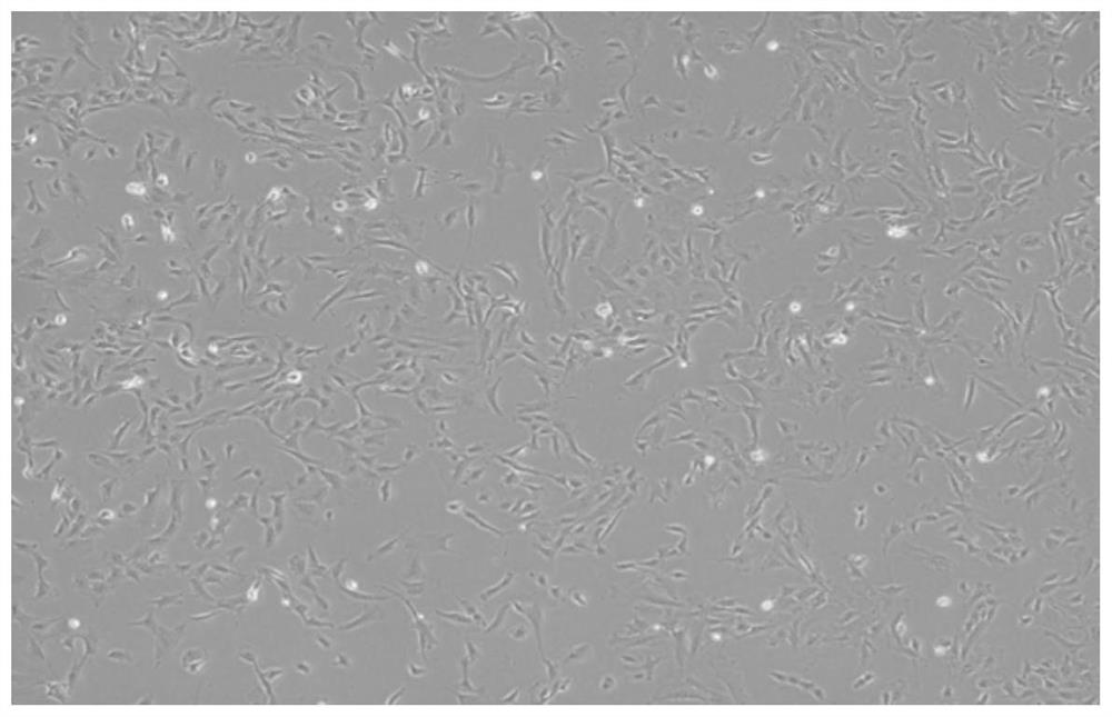 Method for establishing simulated valvular stromal cell calcification model