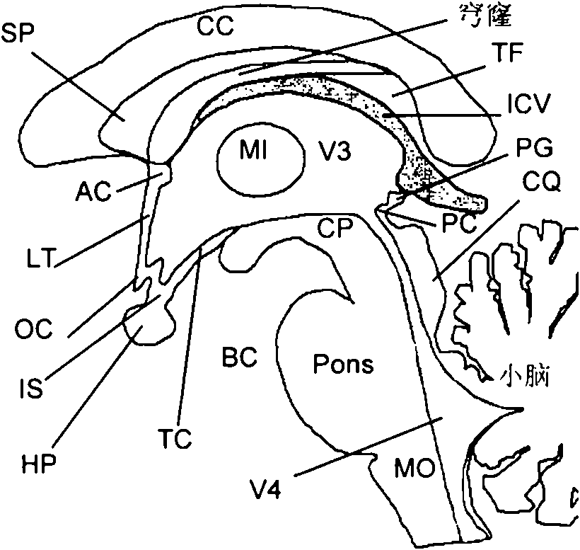 A method and system for anatomy structure segmentation and modeling in an image