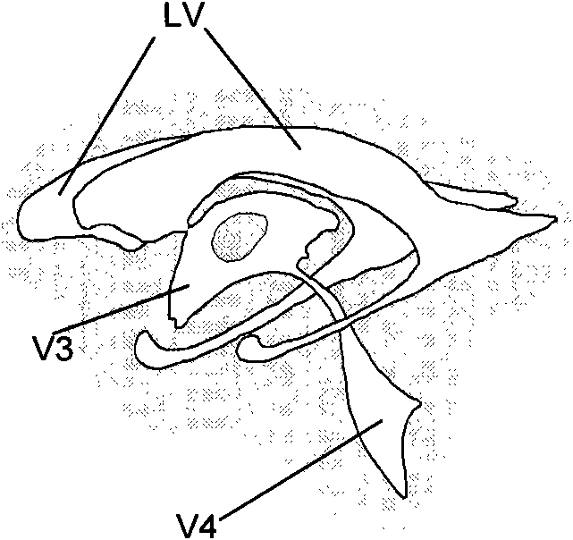 A method and system for anatomy structure segmentation and modeling in an image