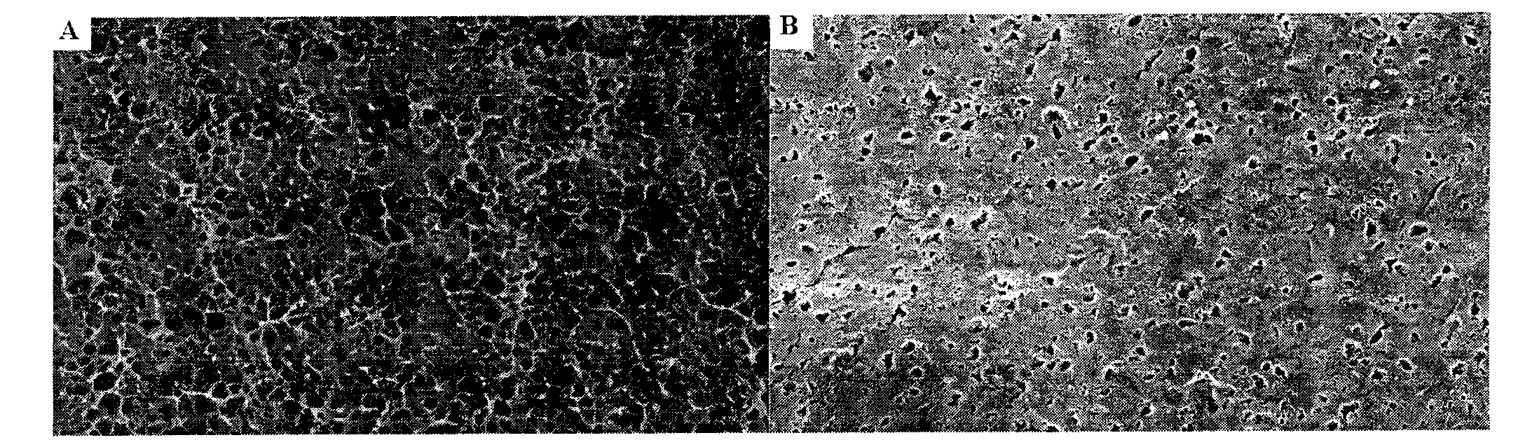 Polyester flat microporous membrane and preparation method thereof