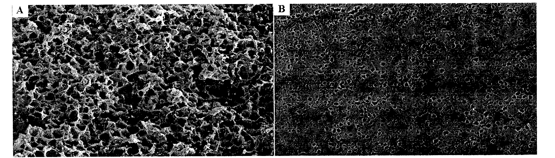 Polyester flat microporous membrane and preparation method thereof