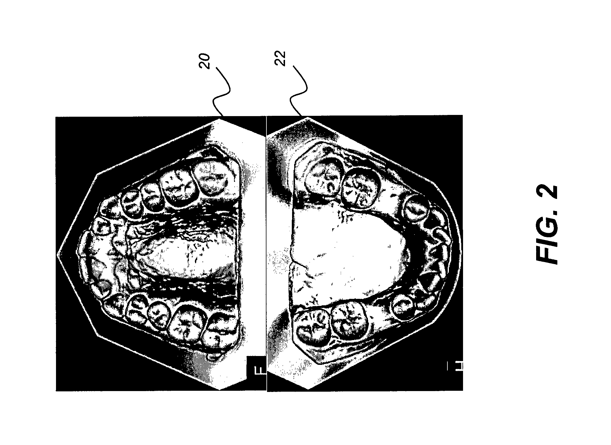 Occlusion mapping using elastic foam modeling