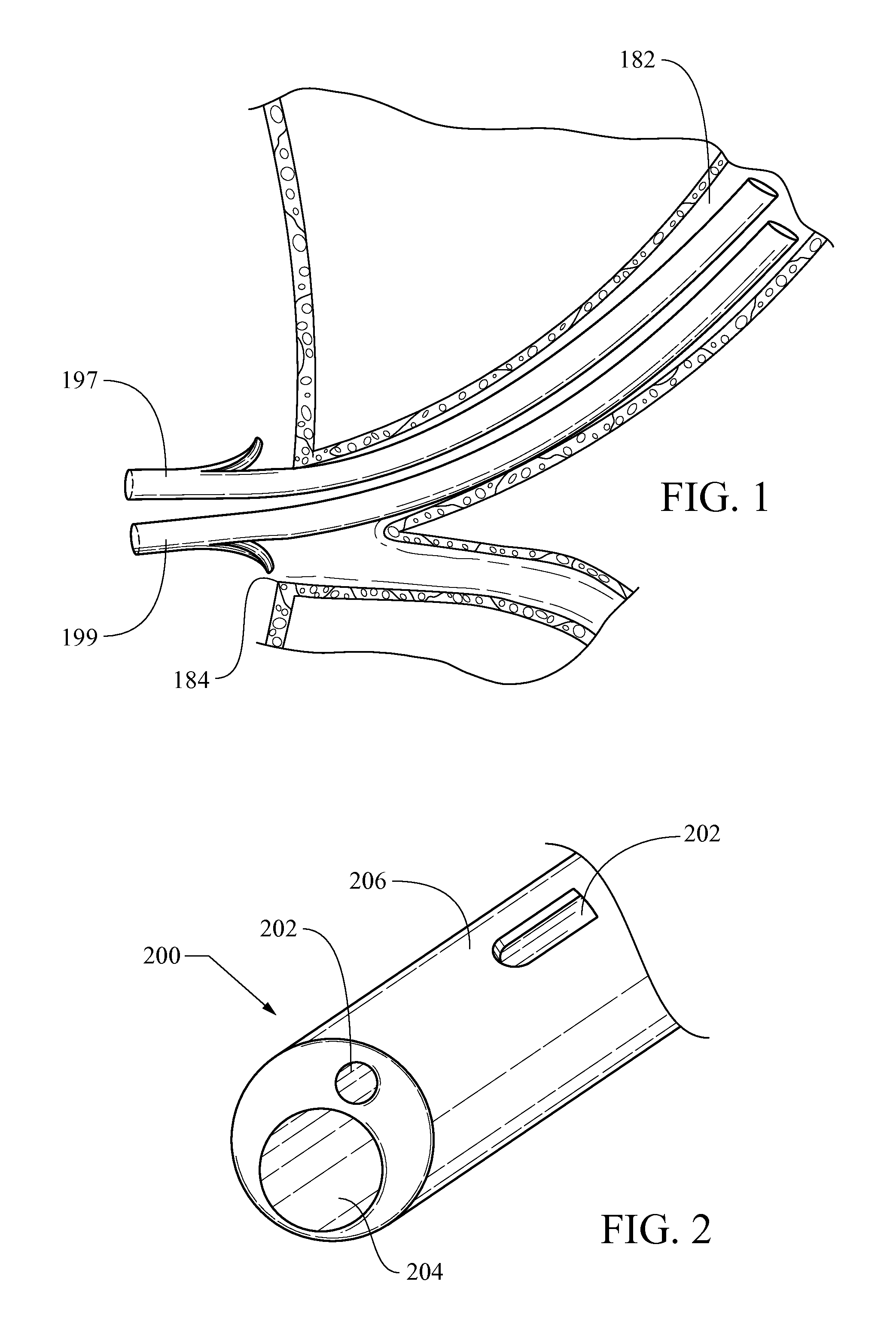 Method of placing multiple biliary stents without re-intervention, and device for same