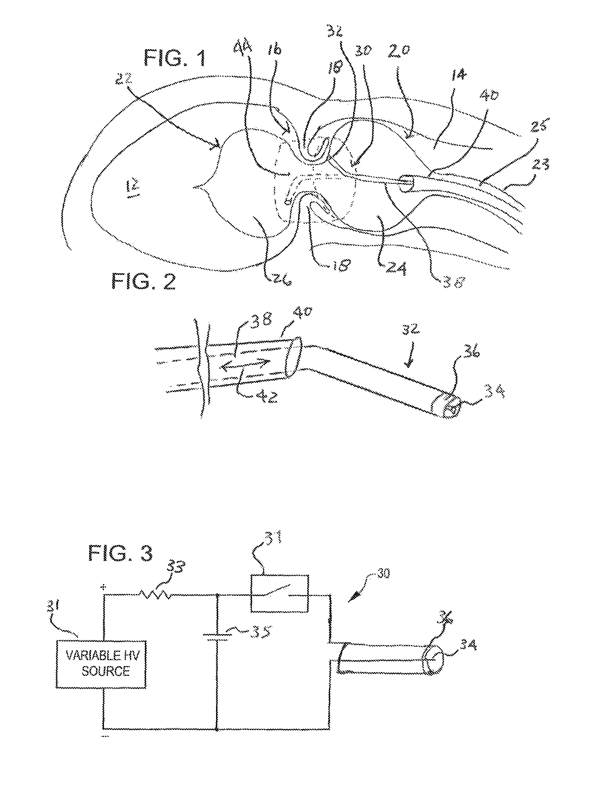 Shock wave valvuloplasty device with moveable shock wave generator