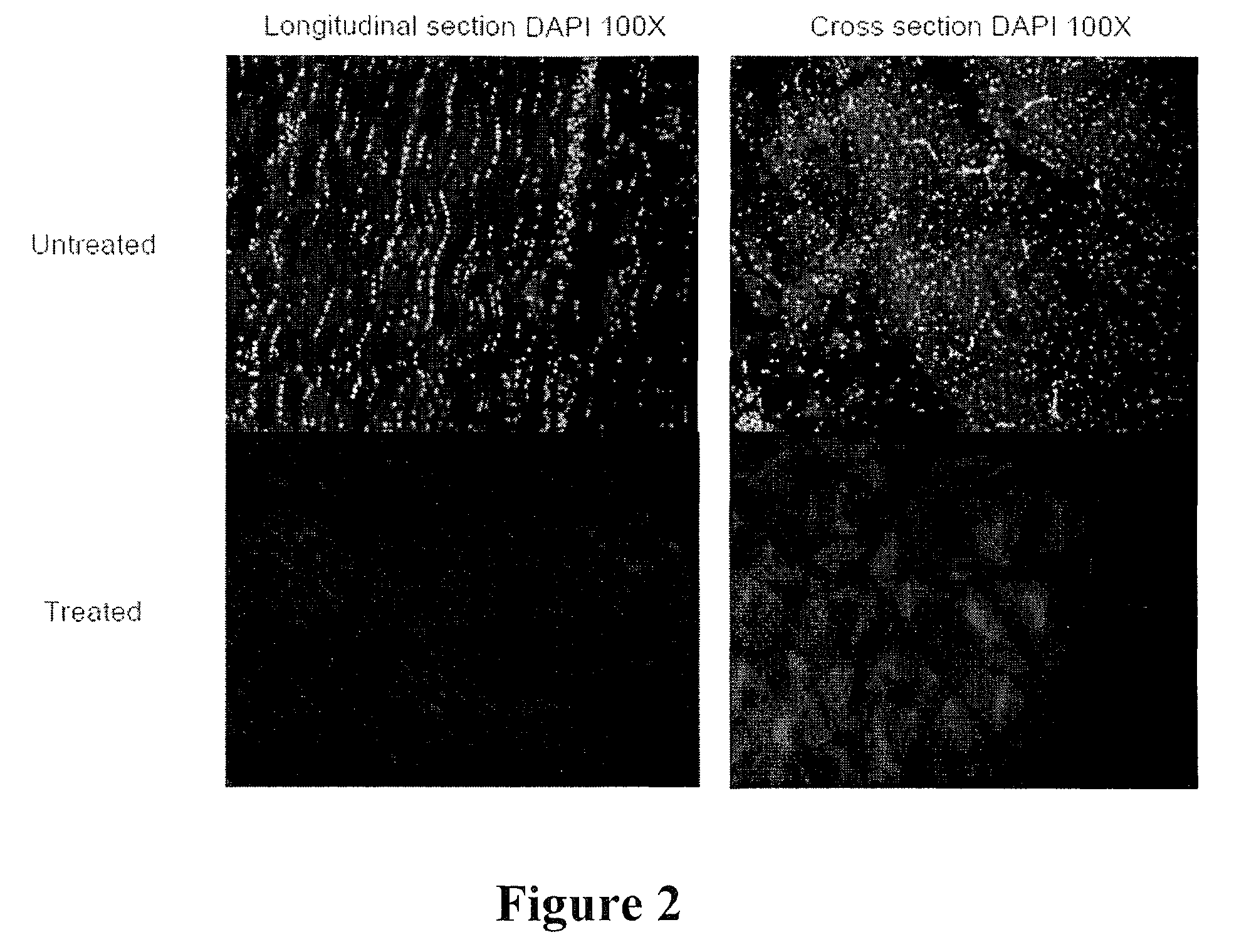 Structurally modified acellular tissue engineering scaffolds and methods of production