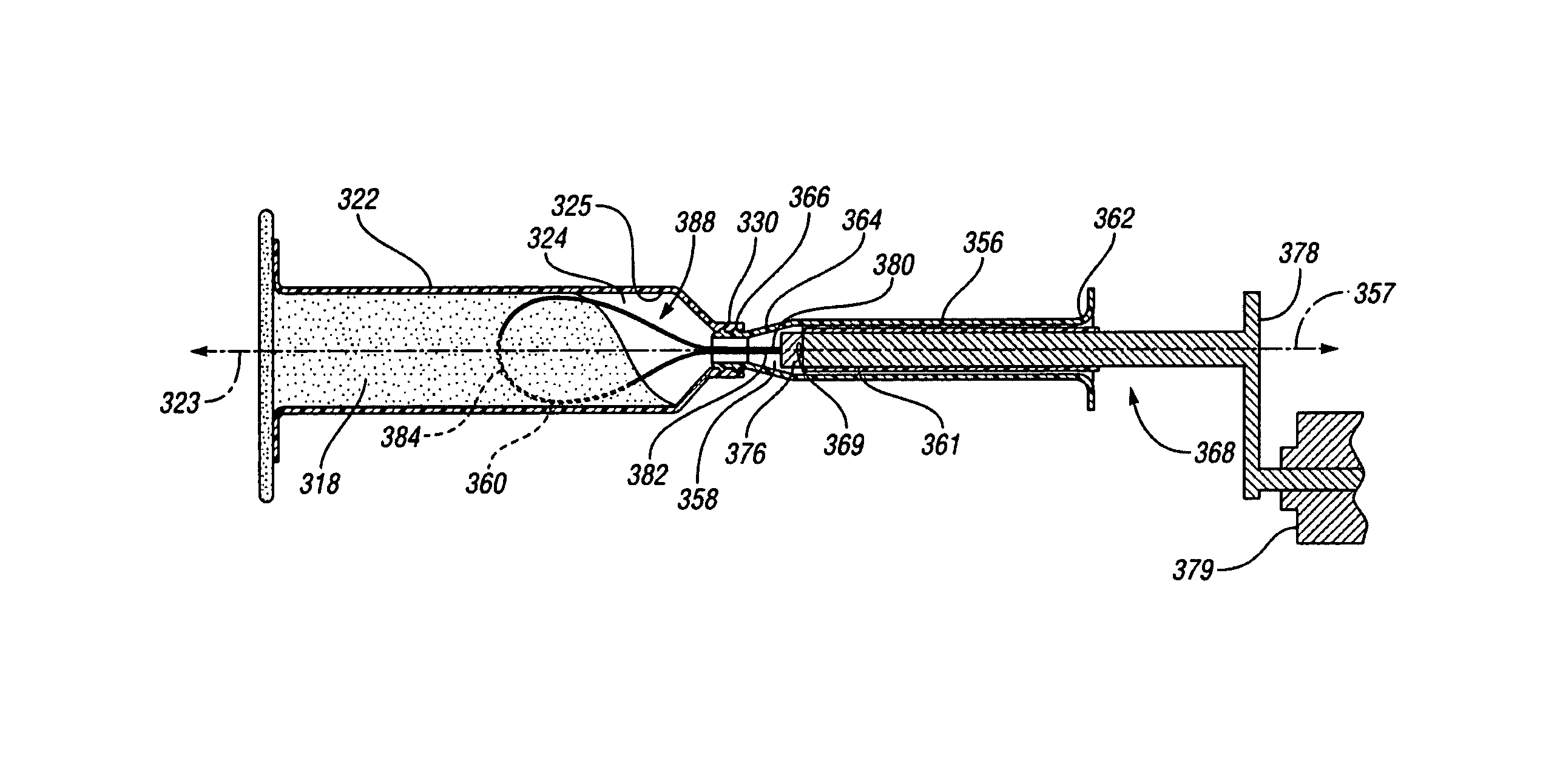 Vertebroplasty all in one mixer