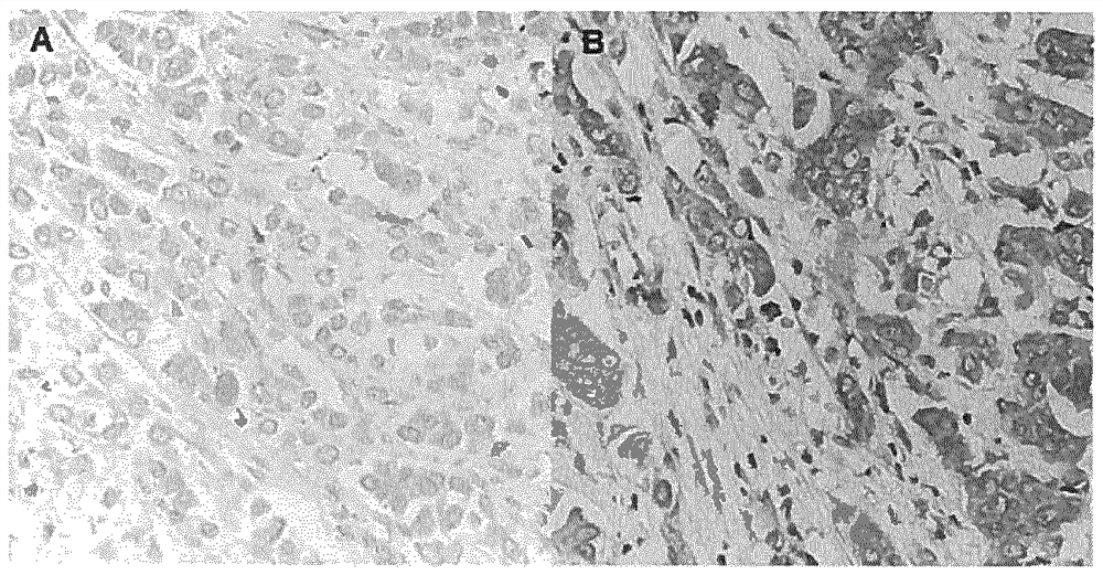 Vaccine for use in prophylaxis and/or treatment of disease