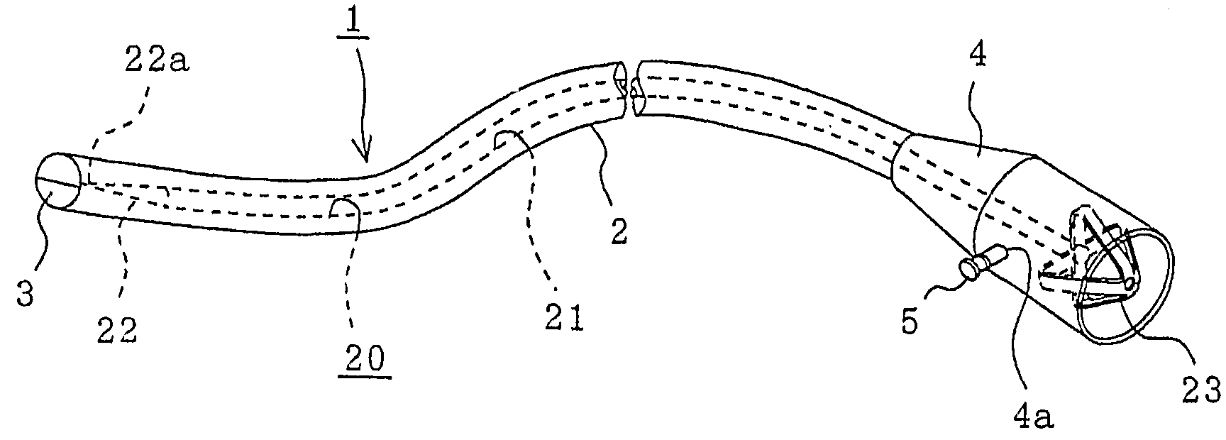 Infection-preventing gastrostomy catheter kit for gastrostomy