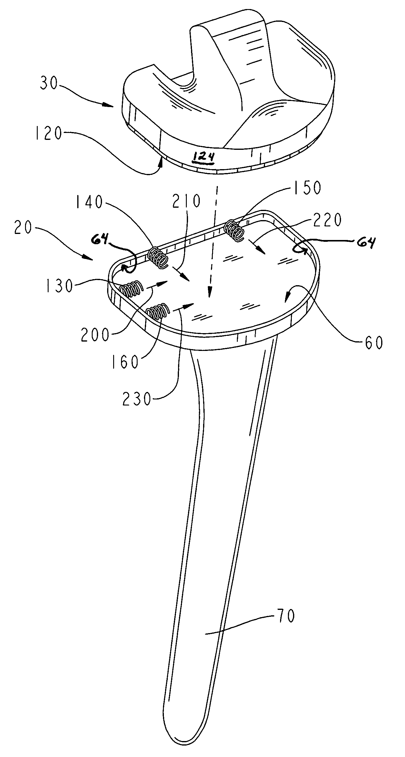 Modular implant with a micro-motion damper