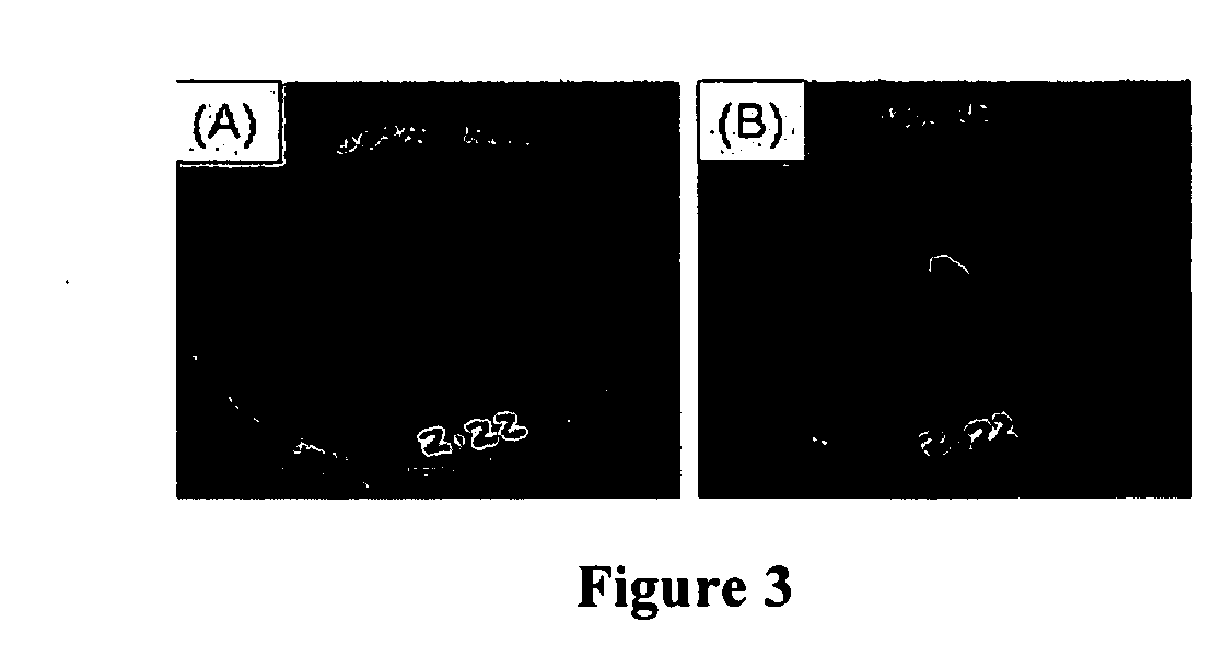 Method for treating/controlling/killing fungi and bacteria