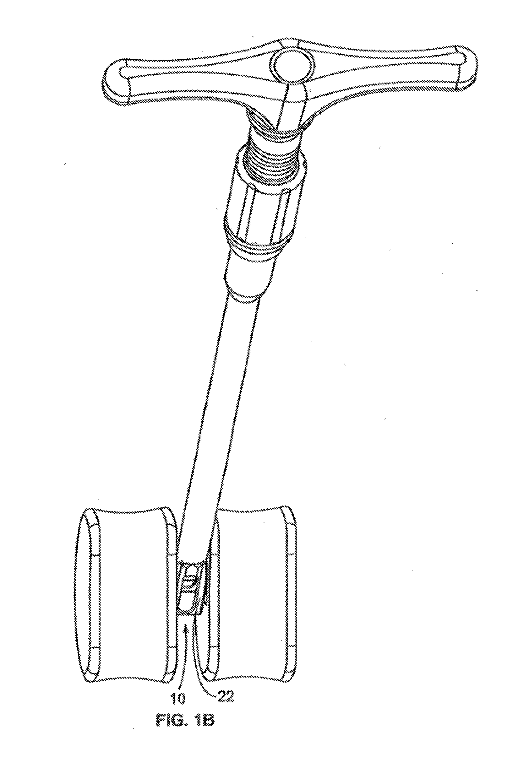 Methods and Systems for Interbody Implant and Bone Graft Delivery