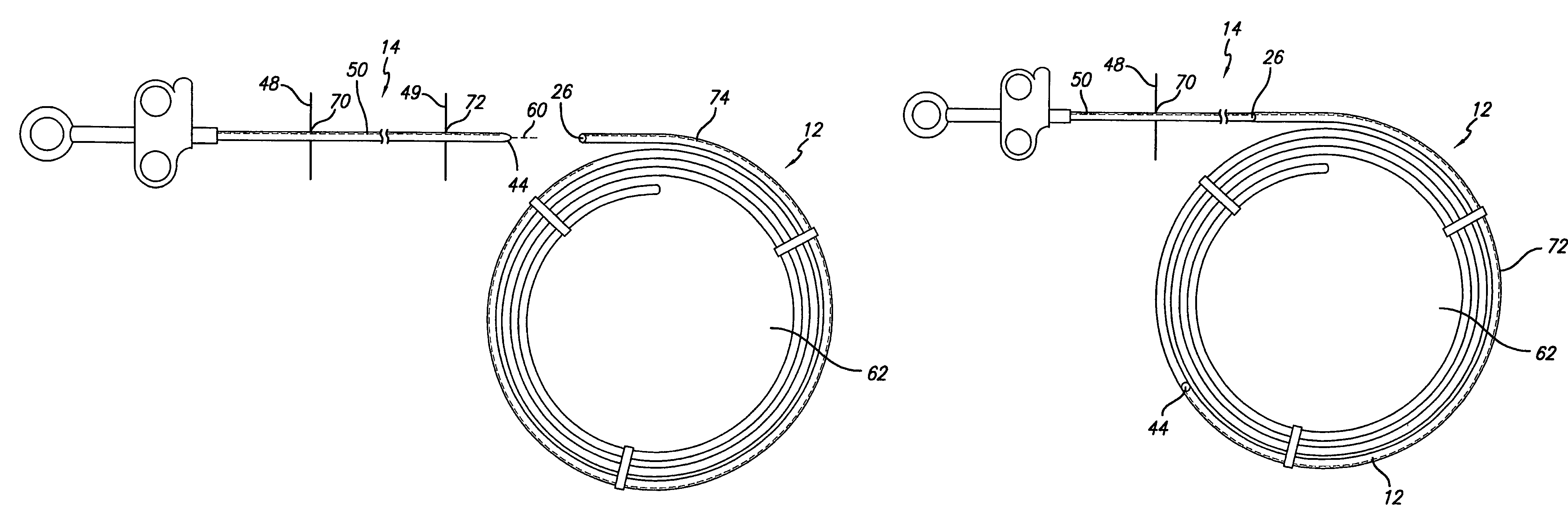 Medical device packaging assembly and method for medical device orientation