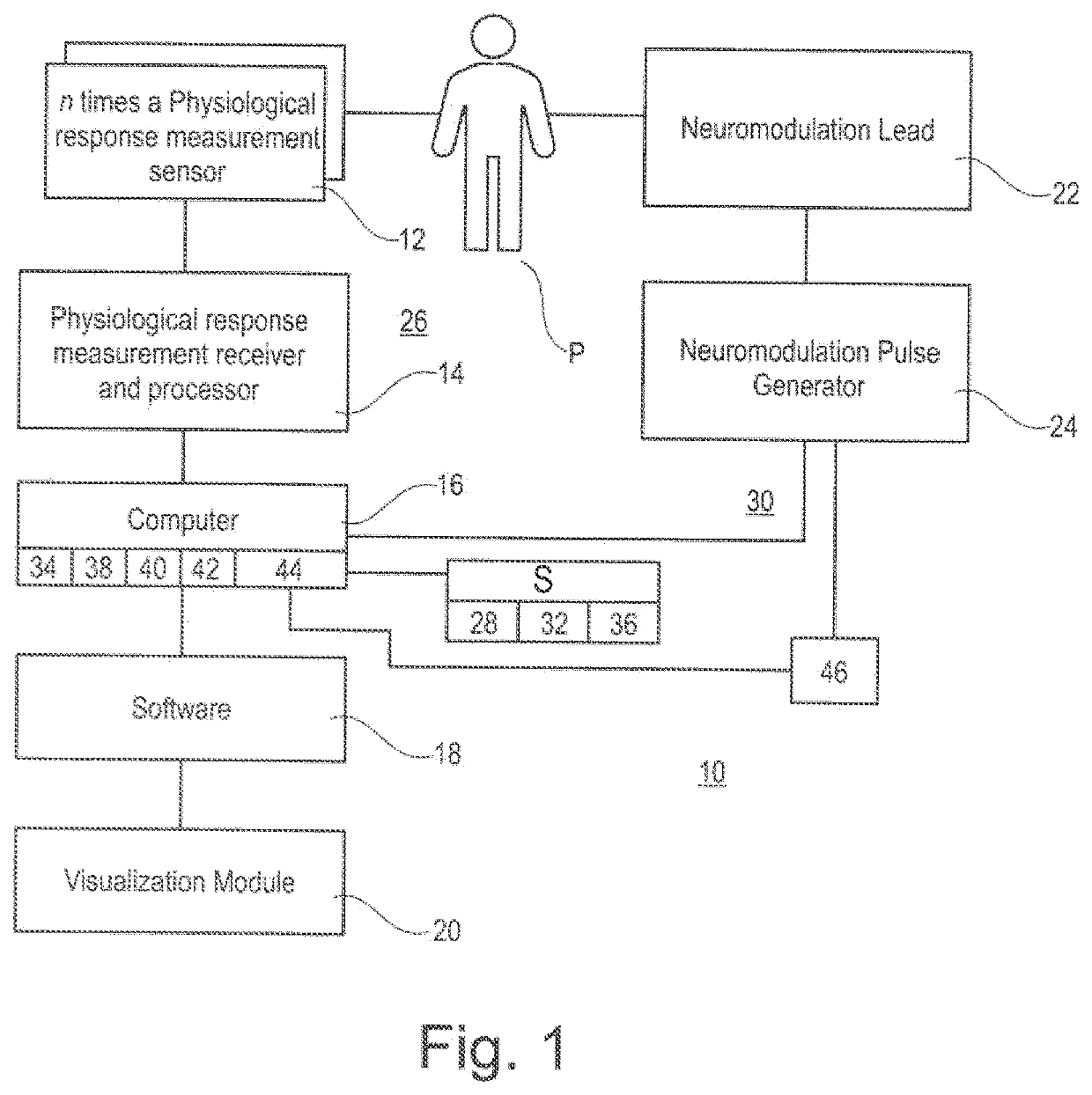 System for planning and/or providing neuromodulation