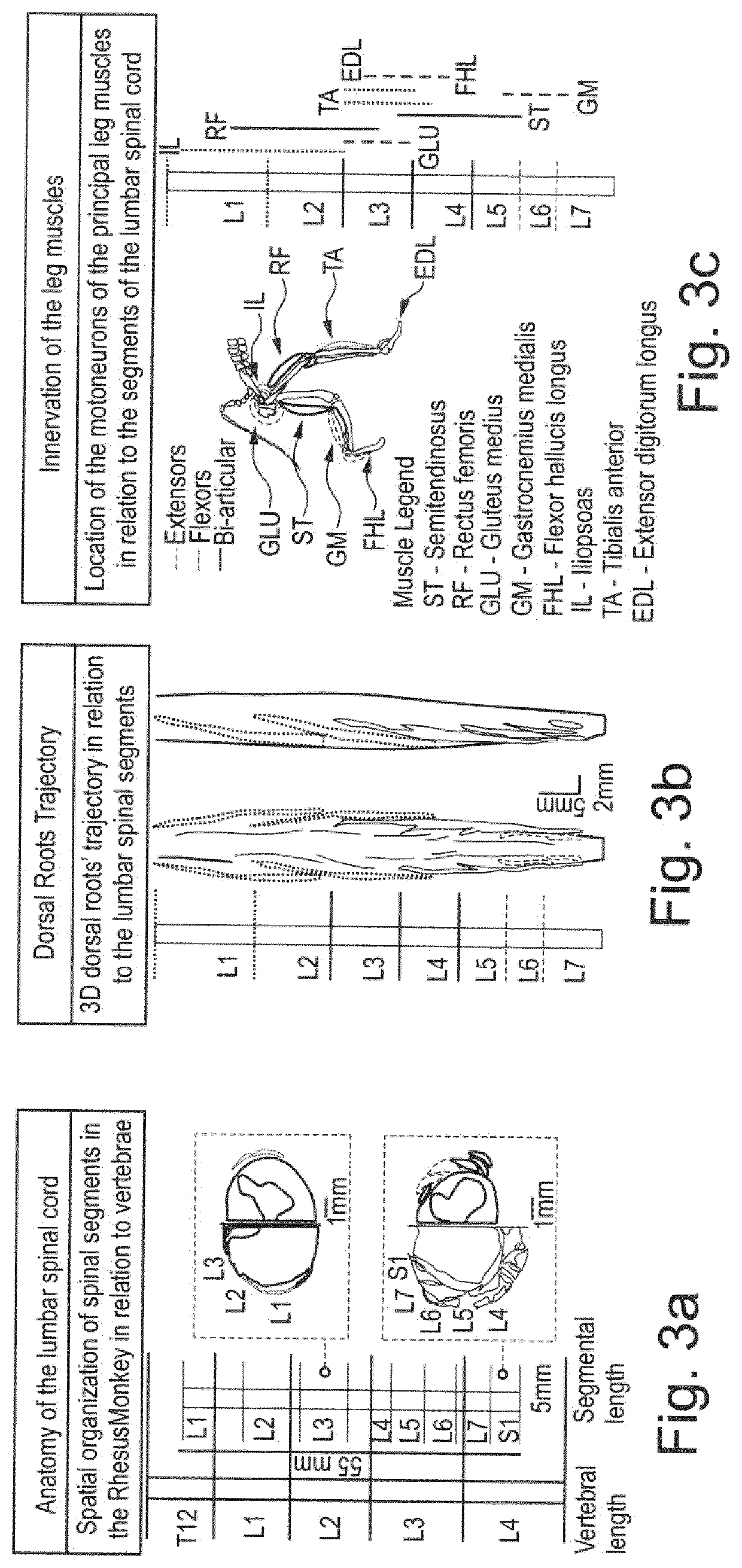 System for planning and/or providing neuromodulation