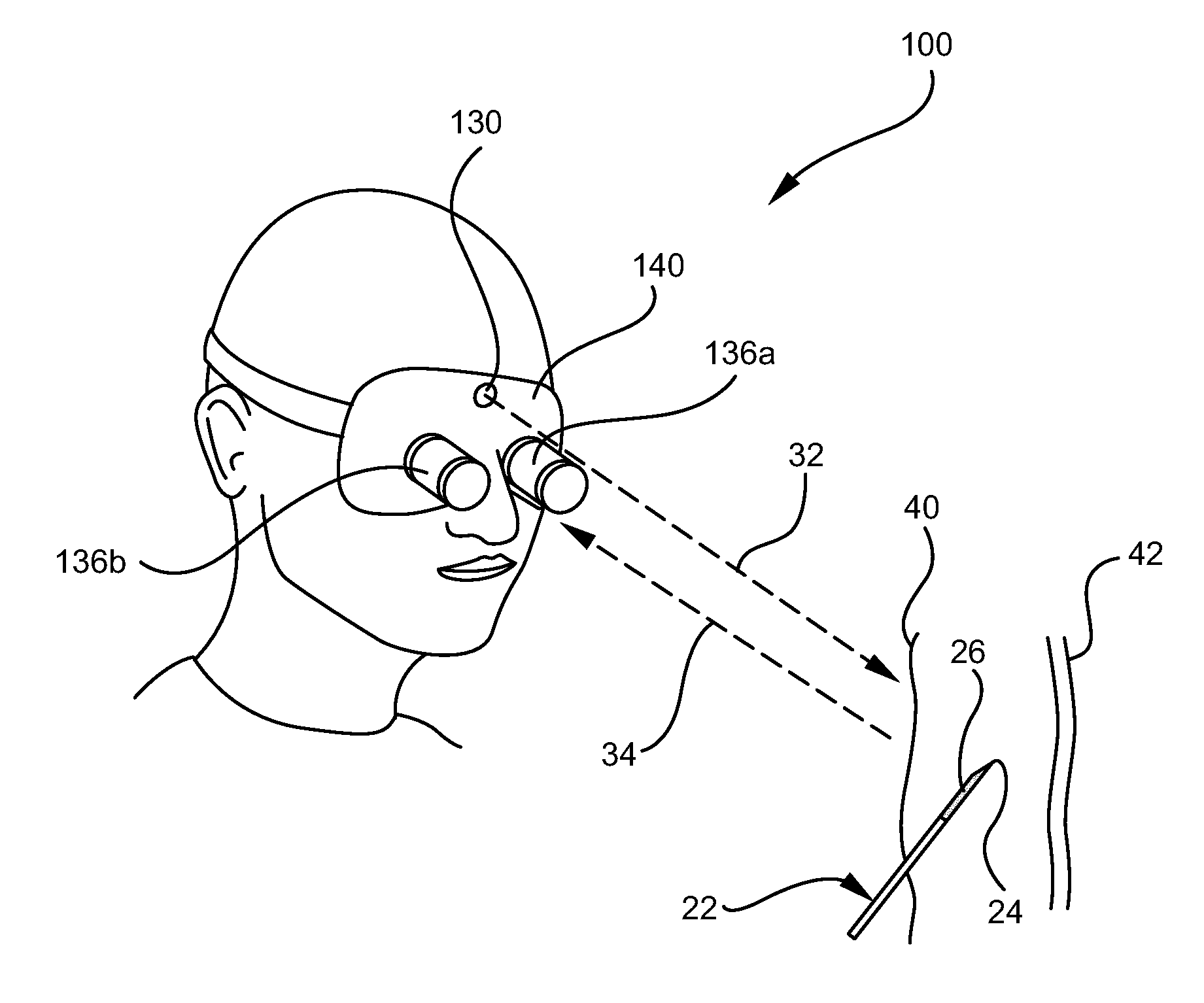 System and method for visualizing needle entry into a body