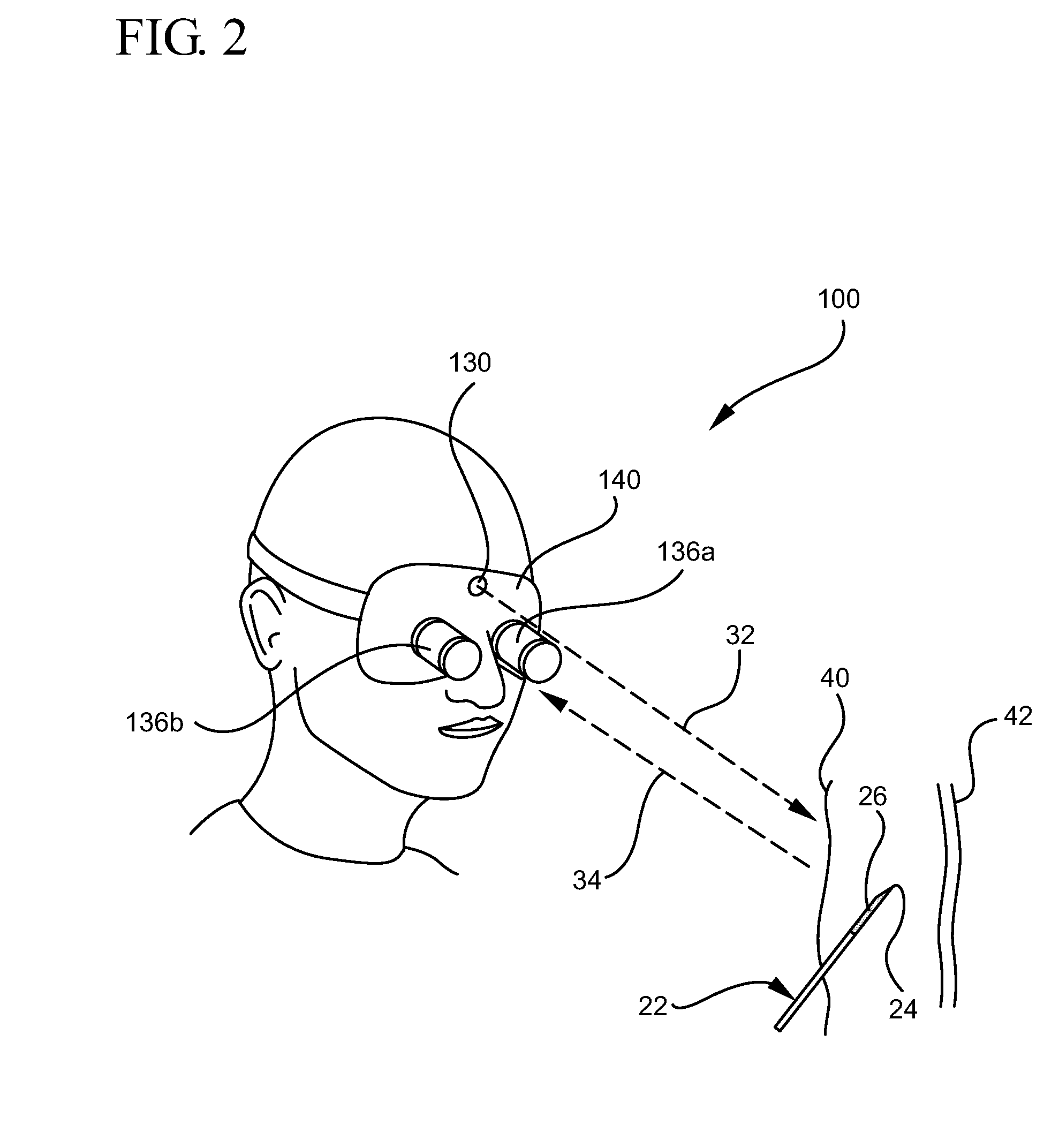 System and method for visualizing needle entry into a body