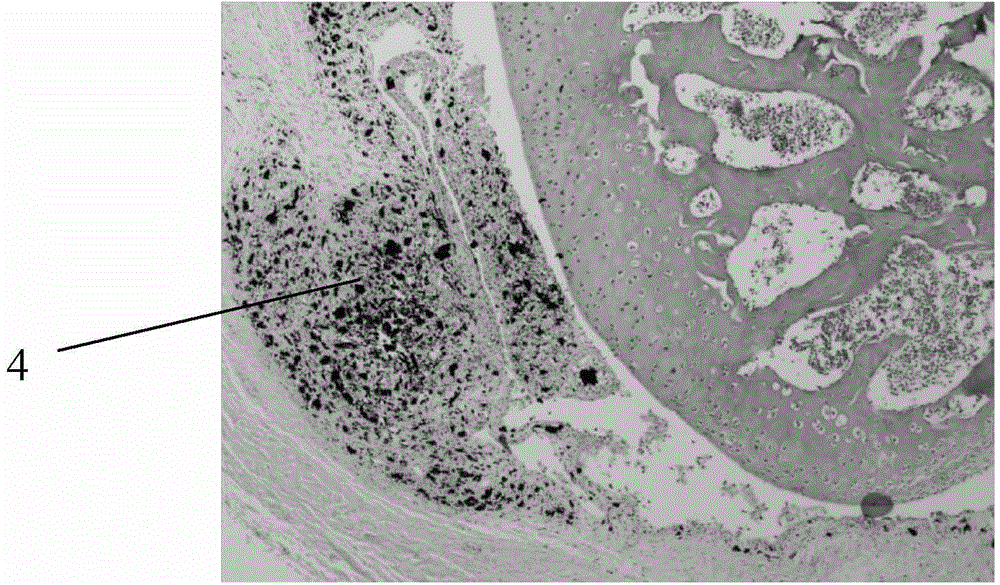 Intra-articular liquid-solid composite lubricating agent and preparation method