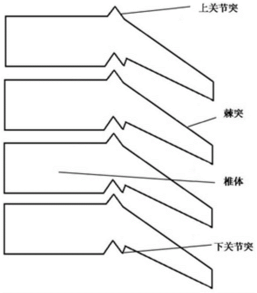 Anterior reduction and internal fixation system for cervical fracture and dislocation