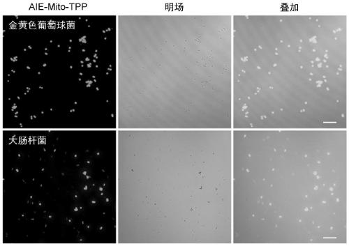 Probe with functions of successive imaging and killing of bacteria and cancer cells and application thereof