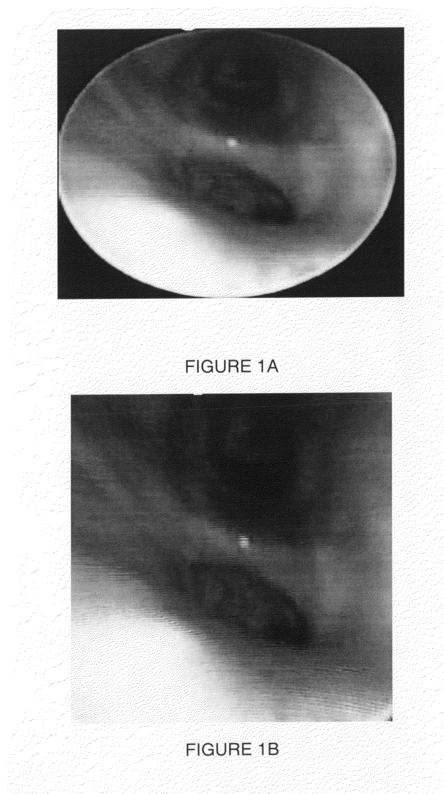 Image-based global registration system and method applicable to bronchoscopy guidance