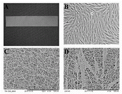 A kind of tissue engineering blood vessel and its preparation method and application