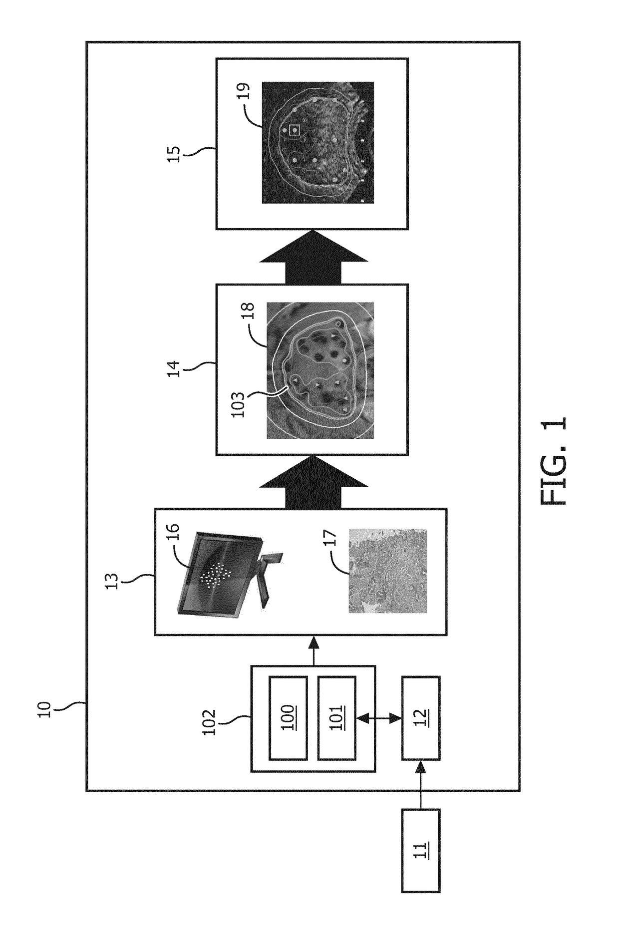 Dose planning system