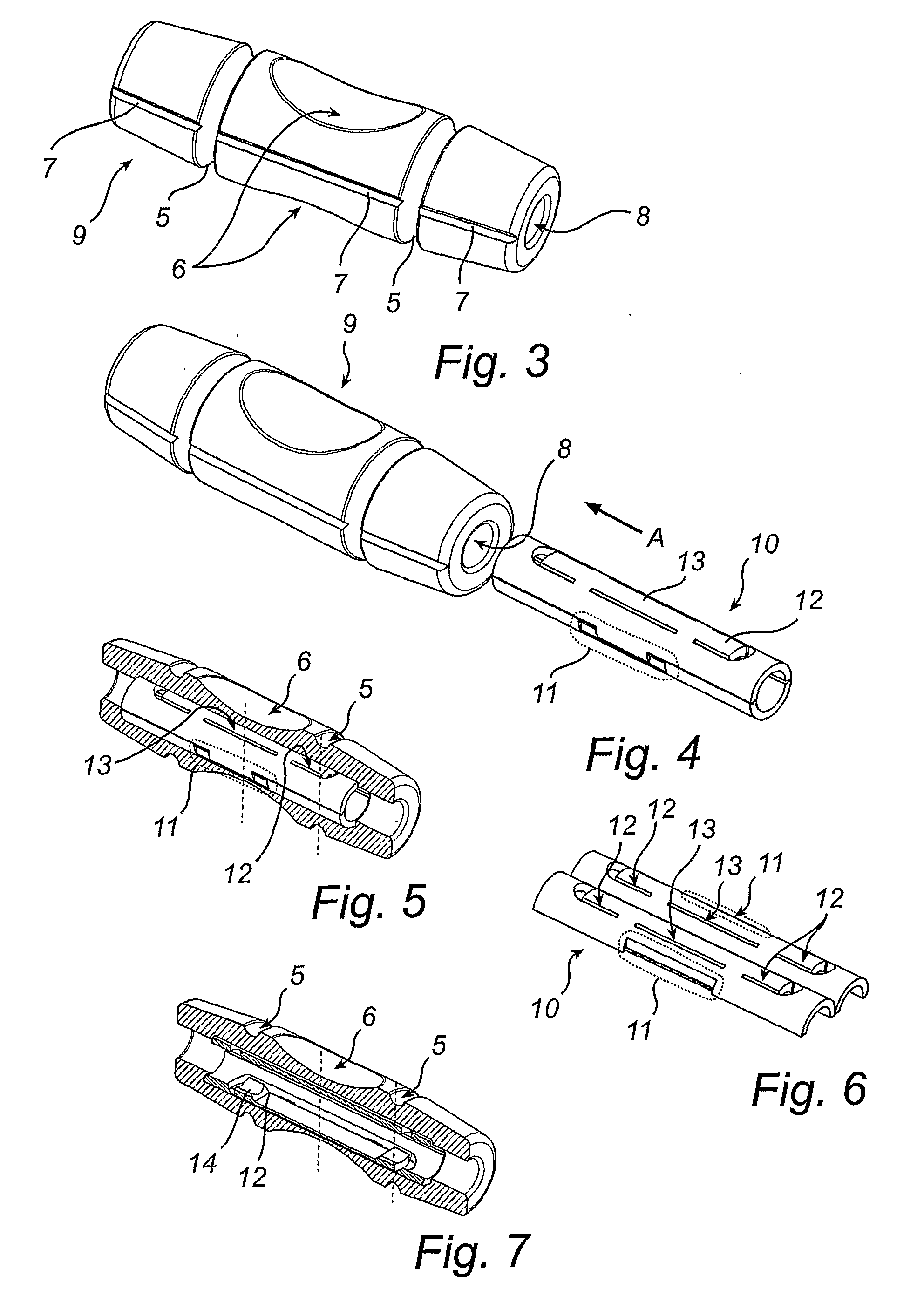 Suture Sleeve