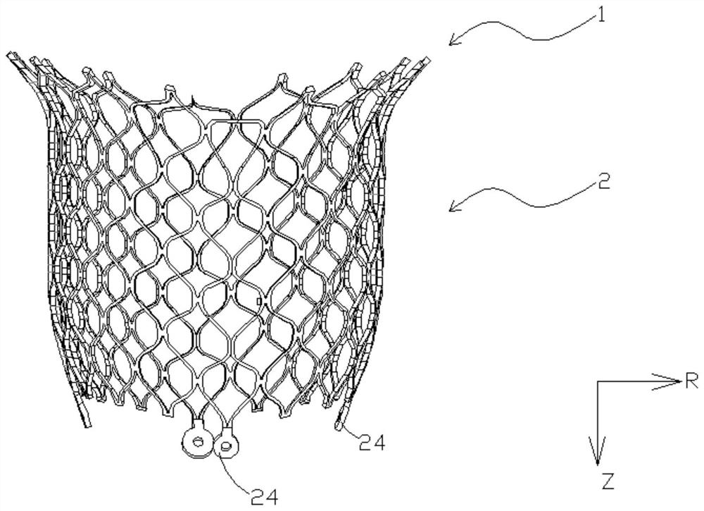 Transcatheter mitral support