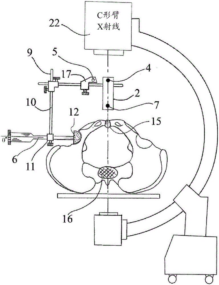 Acetabular cup positioning device and method thereof