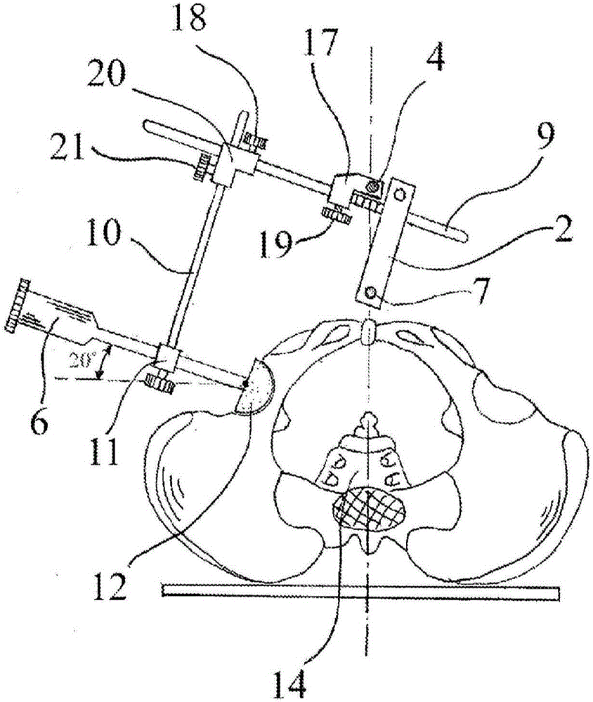 Acetabular cup positioning device and method thereof