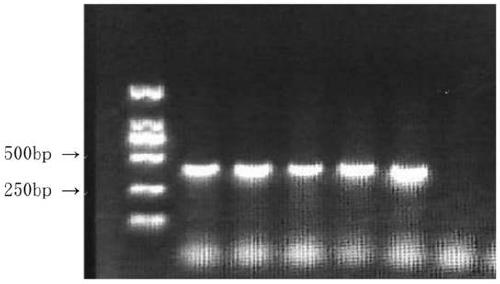 Blattella germanica sodium-ion channel resistance mutant gene and protein, and amplification primer, identification primer and identification method