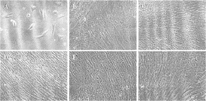 A method for constructing a human umbilical cord mesenchymal stem cell bank