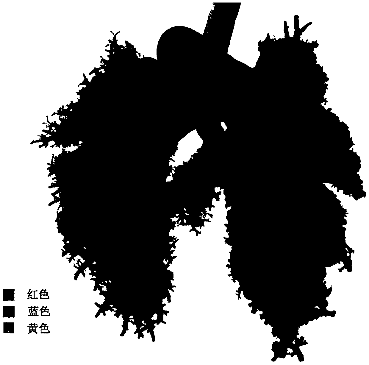 Preparation method of rabbit pulmonary vascular model