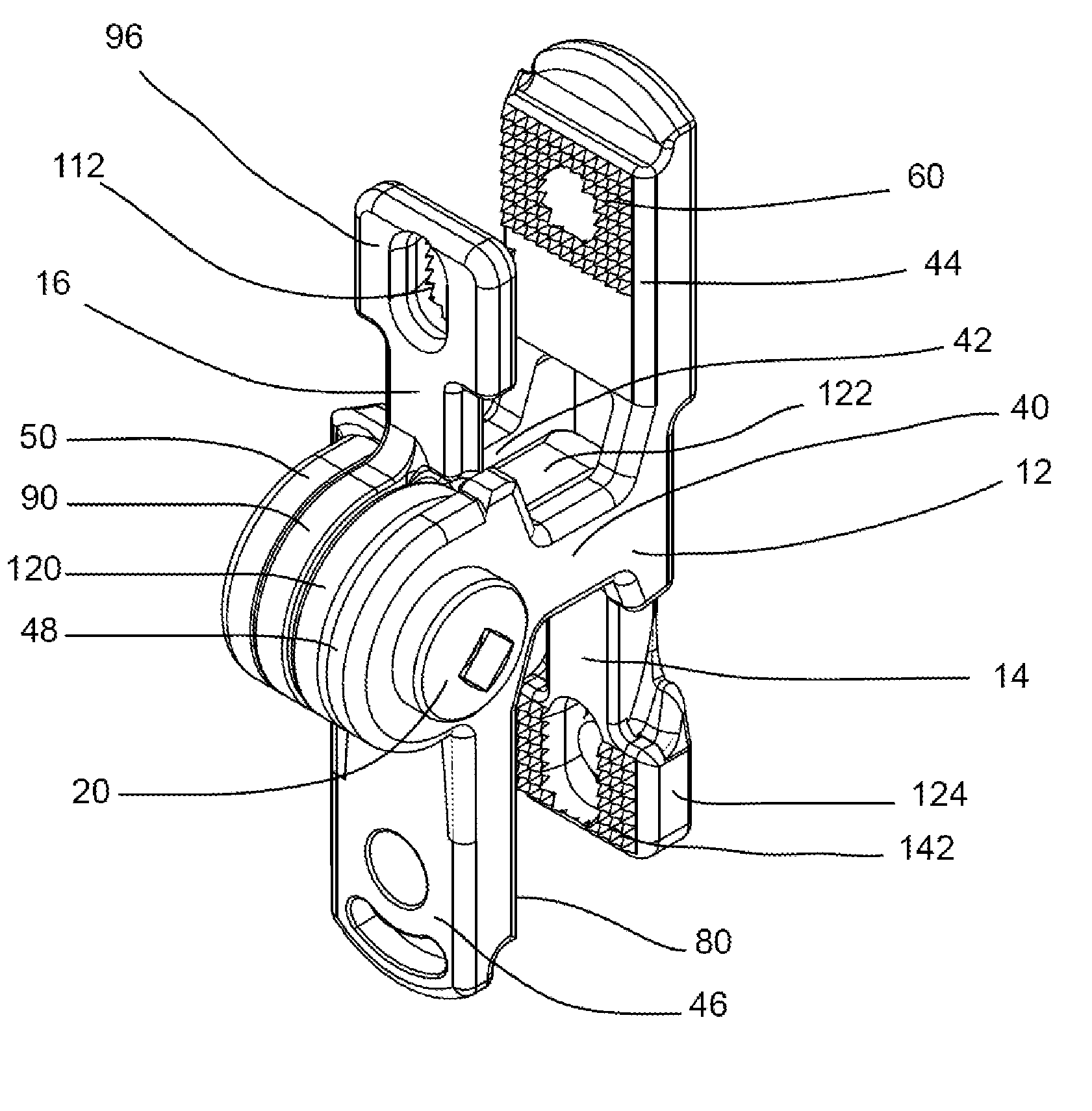 Spinous process fixation device