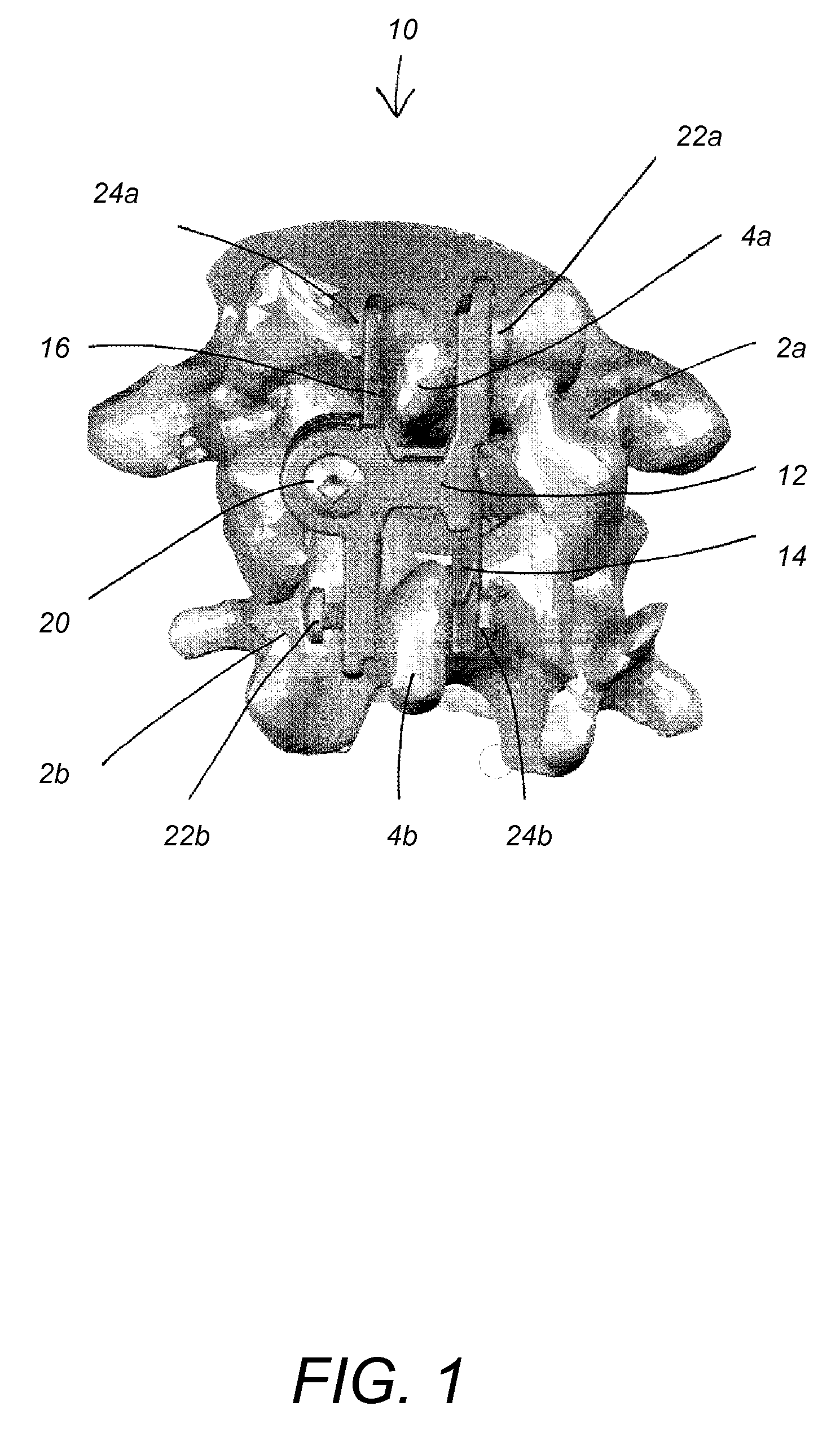 Spinous process fixation device