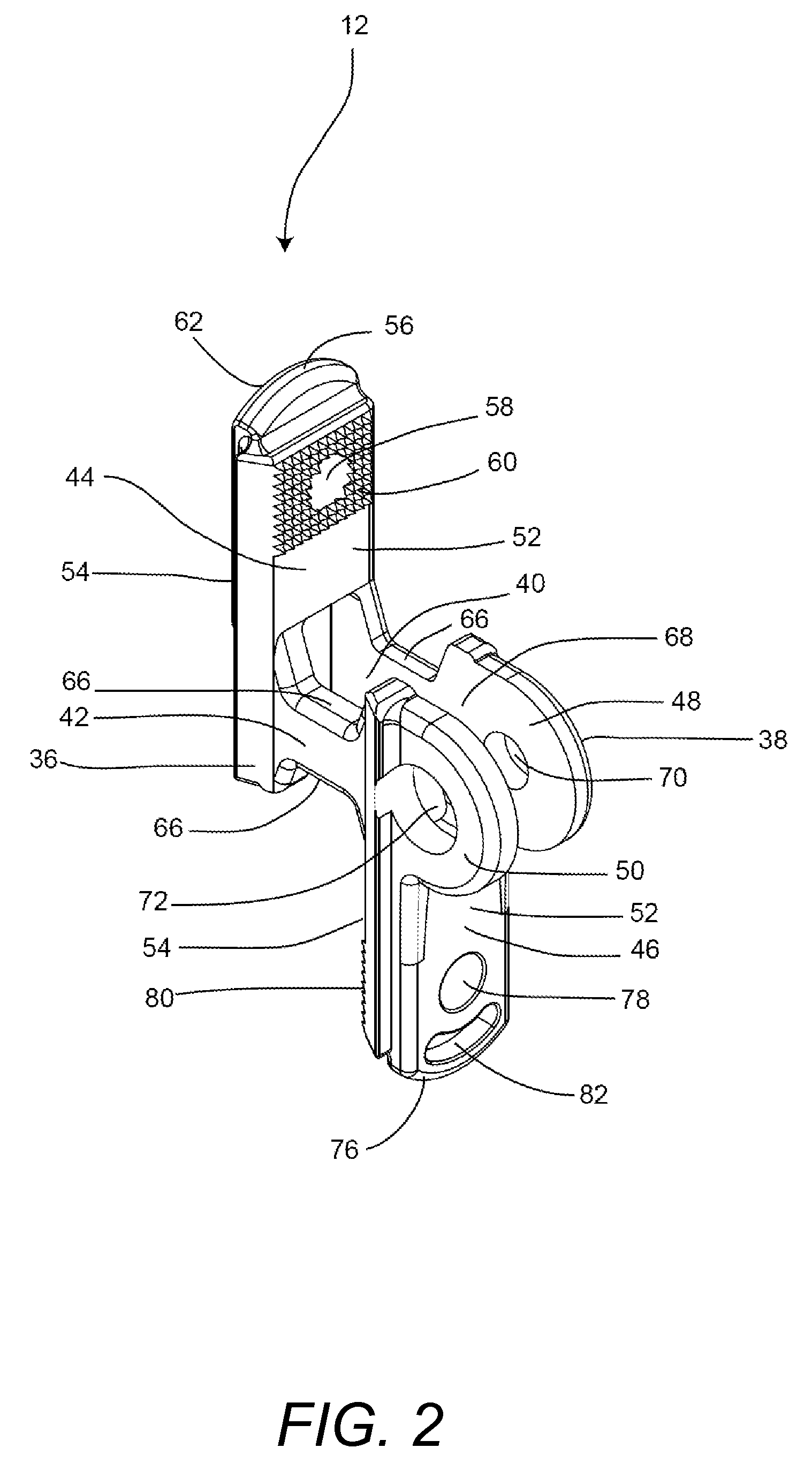 Spinous process fixation device