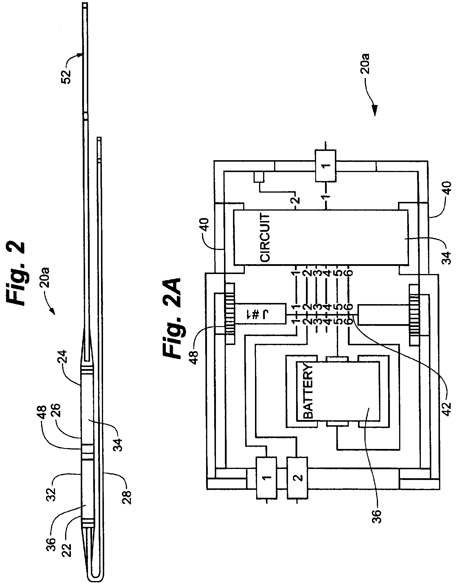 Intravascular implantable device having superior anchoring arrangement